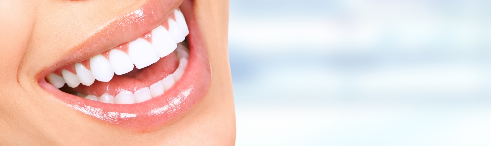 セラミック矯正のイメージ写真