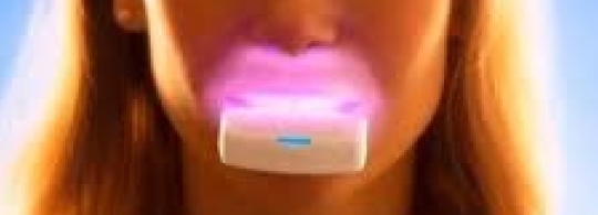 光加速矯正(オルソパルス)