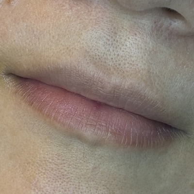 リップアートメイク施術前