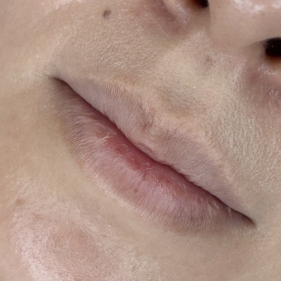 リップアートメイク施術前