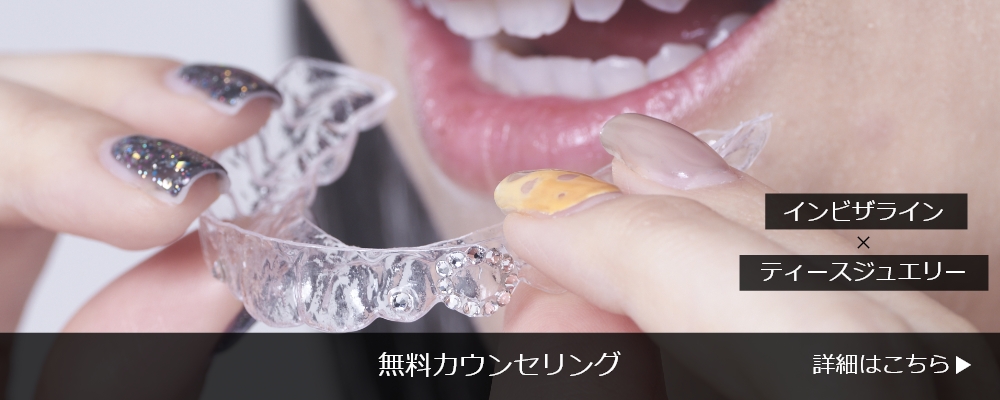 ジュエリーマウスピース矯正