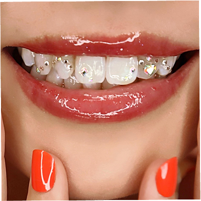 ティースジュエリー（トゥースジェム）のデザイン-写真