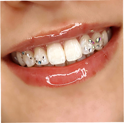 ティースジュエリー（トゥースジェム）のデザイン-写真