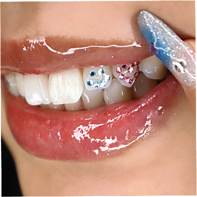 ティースジュエリー（トゥースジェム）のデザイン-写真