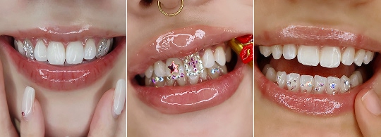 ティースジュエリー