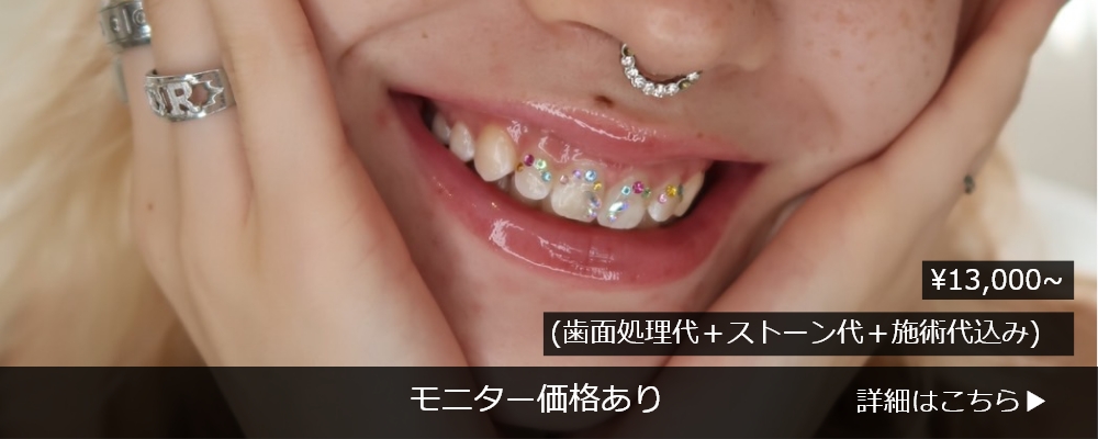 ティースジュエリー